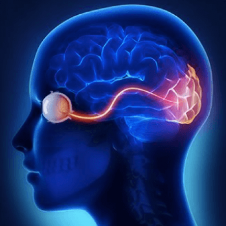Neuro-ophthalmology-urmi-eye-clinic-thane